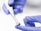 Jak długo po usunięciu zęba można wszczepić implant?