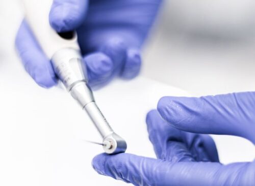 Jak długo po usunięciu zęba można wszczepić implant?