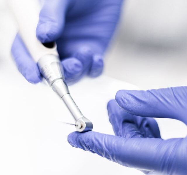 Jak długo po usunięciu zęba można wszczepić implant?