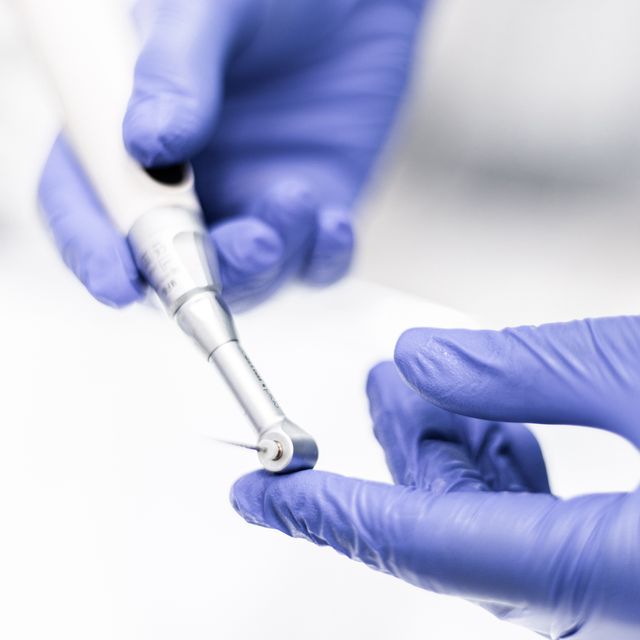 Jak długo po usunięciu zęba można wszczepić implant?