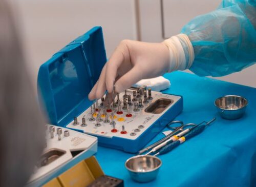 Jak przygotować się do wszczepienia implantu zęba?